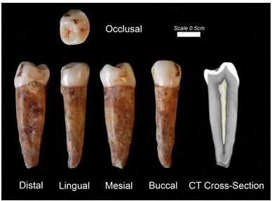 イスラエルで発見された40万年前の人類の歯 イスラエルで発見された40万年前の人類の歯